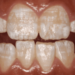 IMG - DENTE COM HMI - 12_v01